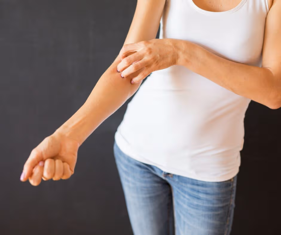Everything You Need to Know About Alcohol Withdrawal Itching